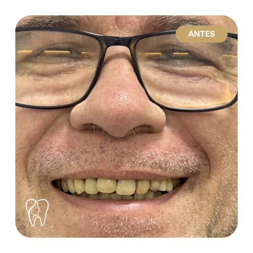 conti antes depois 01