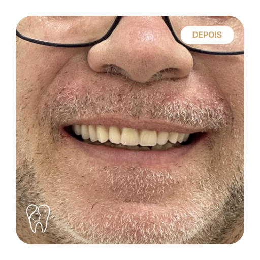 conti antes depois 02