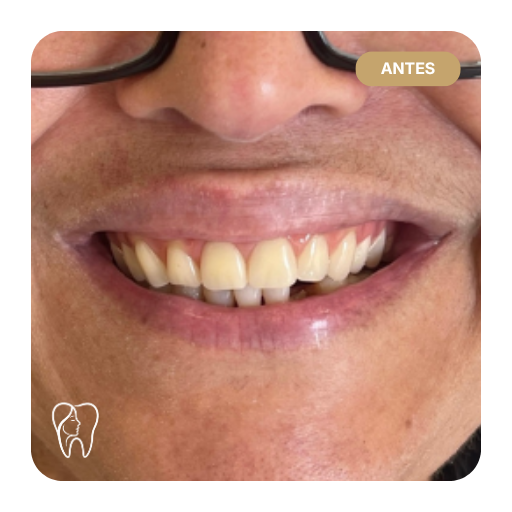 conti antes depois 03