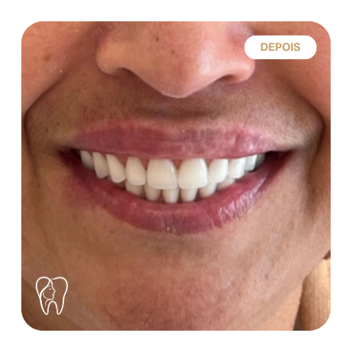 conti antes depois 04